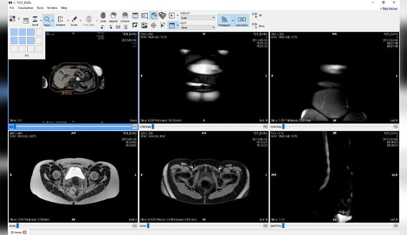 Starviewer Medical 0.14.0
