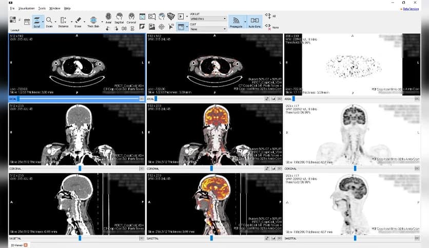 Starviewer Medical 0.14.0