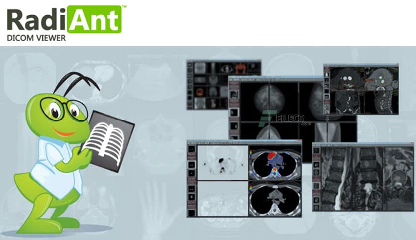 RadiAnt DICOM Viewer 2023.1
