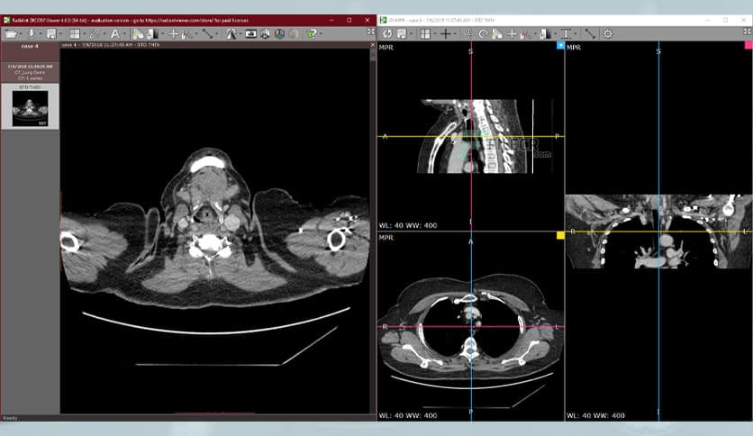 RadiAnt DICOM Viewer 2023.1