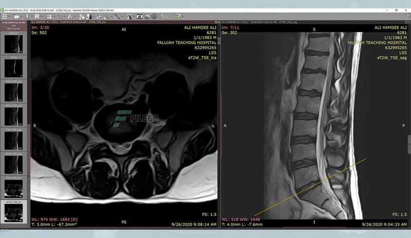 RadiAnt DICOM Viewer 2023.1