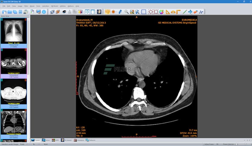 Sante DICOM Editor 3D 4.9.4