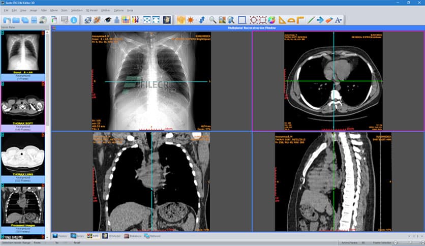 Sante DICOM Editor 3D 4.9.4