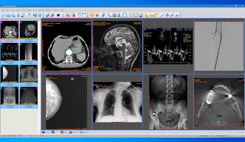 Sante DICOM Editor 10.3.1