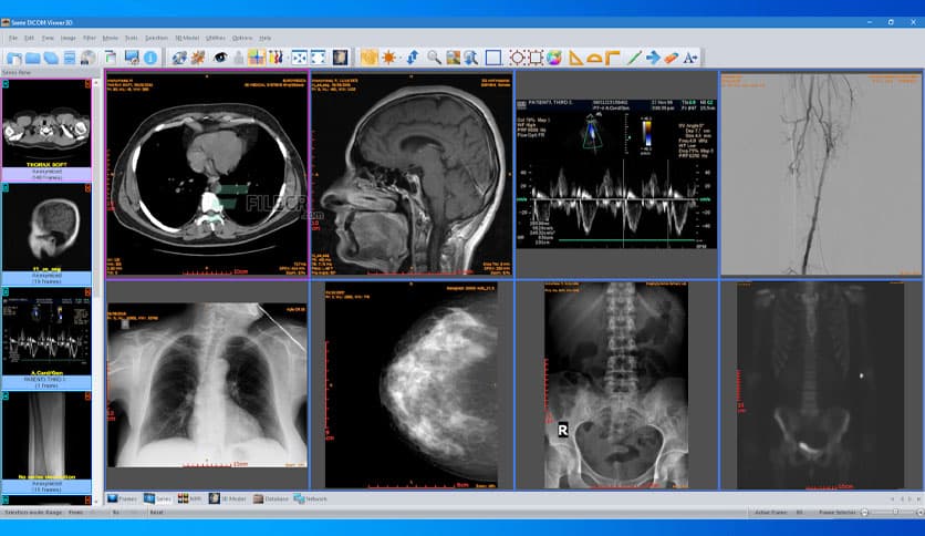Sante DICOM Viewer 3D Pro 4.9.4