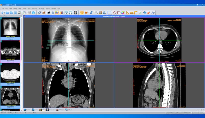 Sante DICOM Viewer 3D Pro 4.9.4