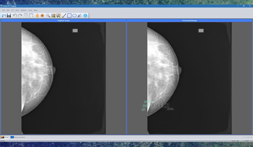 Sante FFT Imaging 1.4.4