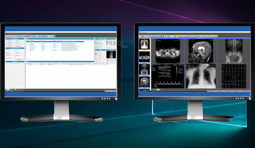 Sante PACS Server 4.4.5