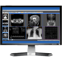 Sante PACS Server 4.4.5